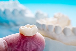 A closeup of a dental crown sitting on a person’s finger