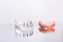 Clear model jaw with implants next to sample dentures